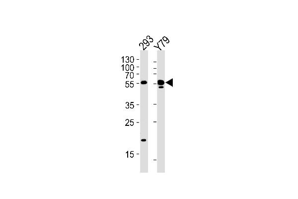 ALDH1A3 Antikörper  (N-Term)
