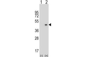 Western Blotting (WB) image for anti-alpha-2-Glycoprotein 1, Zinc-Binding (AZGP1) antibody (ABIN3002718) (AZGP1 Antikörper)