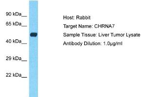 Host: Rabbit Target Name: CHRNA7 Sample Type: Liver Tumor lysates Antibody Dilution: 1.