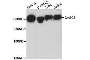 Western blot analysis of extracts of various cell lines, using CASC5 antibody. (CASC5 Antikörper  (AA 1-300))