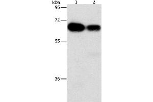 Western Blot analysis of Hela and K562 cell using ARHGEF5 Polyclonal Antibody at dilution of 1:1150 (ARHGEF5 Antikörper)