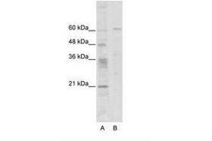 Image no. 1 for anti-Zinc Finger Protein 192 (ZNF192) (N-Term) antibody (ABIN6736101) (ZNF192 Antikörper  (N-Term))