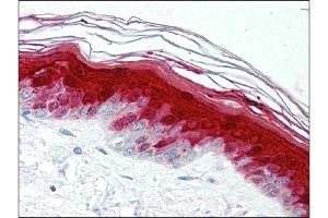 Immunohistochemistry (IHC) image for anti-S100 Calcium Binding Protein A7 (S100A7) antibody (ABIN400722) (S100A7 Antikörper)