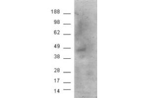 Image no. 2 for anti-Cannabinoid Receptor 1 (CNR1) (Internal Region) antibody (ABIN374611) (CNR1 Antikörper  (Internal Region))