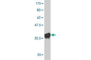 Western Blot detection against Immunogen (36. (OXSR1 Antikörper  (AA 351-450))