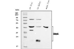 Western blot analysis of Cathepsin L/MEP/Ctsl using anti-Cathepsin L/MEP/Ctsl antibody (ABIN7603032).