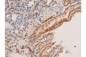 ABIN6256251 and ABIN6267221 at 1/100 staining rat lung tissue sections by IHC-P. (CHEK1 Antikörper  (pSer296))