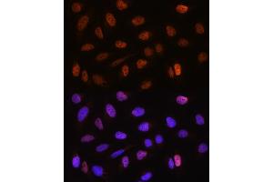Immunofluorescence analysis of U2OS cells using CSTF2T Rabbit pAb (ABIN6131580, ABIN6139164, ABIN6139165 and ABIN6220675) at dilution of 1:100. (CSTF2T Antikörper  (AA 420-560))