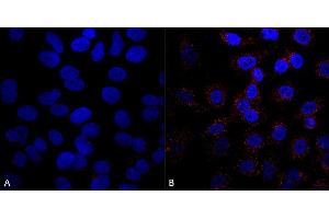 Immunocytochemistry/Immunofluorescence analysis using Mouse Anti-VPS35 Monoclonal Antibody, Clone 5A9 (ABIN6932932). (VPS35 Antikörper)