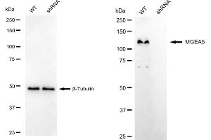 Western blotting analysis using MGEA5 antibody (ABIN7799372). (Rekombinanter MGEA5 Antikörper)