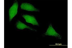 Immunofluorescence of purified MaxPab antibody to IRF3 on HeLa cell. (IRF3 Antikörper  (AA 1-427))