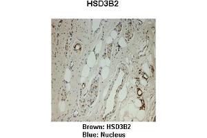 Sample Type :  Monkey vagina   Primary Antibody Dilution :   1:25   Secondary Antibody:  Anti-rabbit-HRP   Secondary Antibody Dilution:   1:1000   Color/Signal Descriptions:  Brown: HSD3B2 Blue: Nucleus   Gene Name:  HSD3B2   Submitted by:  Jonathan Bertin, Endoceutics Inc.