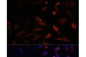 Immunofluorescence analysis of U2OS cells using CLDN5 Polyclonal Antibody at dilution of 1:100. (Claudin 5 Antikörper)