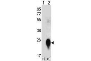 Western blot analysis of CLEC3B (arrow) using rabbit polyclonal CLEC3B Antibody (Center) . (CLEC3B Antikörper  (Middle Region))