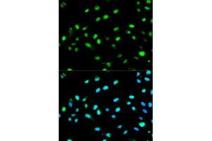 Immunofluorescence analysis of MCF7 cell using LETMD1 antibody. (LETMD1 Antikörper)