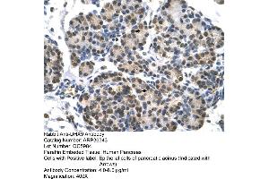 Human Pancreas (DHX9 Antikörper  (N-Term))