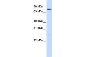 NOTCH1 antibody used at 2. (Notch1 Antikörper  (Middle Region))