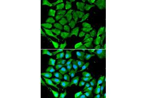 Immunofluorescence analysis of A549 cell using PPARG antibody. (PPARG Antikörper)