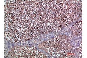 Immunohistochemistry (IHC) image for anti-Chemokine (C-C Motif) Ligand 2 (CCL2) (AA 31-80) antibody (ABIN7189484)