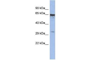 WB Suggested Anti-MAGEA9 Antibody Titration:  0. (MAGEA9 Antikörper  (Middle Region))