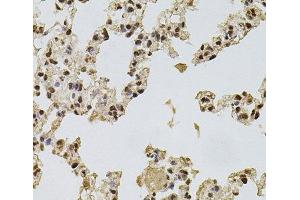 Immunohistochemistry of paraffin-embedded Rat lung using FGF2 Polyclonal Antibody at dilution of 1:100 (40x lens). (FGF2 Antikörper)