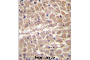 TRIM11 Antibody (C-term) (ABIN657207 and ABIN2846320) immunohistochemistry analysis in formalin fixed and paraffin embedded human heart tissue followed by peroxidase conjugation of the secondary antibody and DAB staining. (TRIM11 Antikörper  (C-Term))