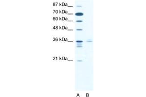Western Blotting (WB) image for anti-LIM Homeobox 3 (LHX3) antibody (ABIN2460468) (LHX3 Antikörper)