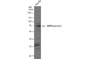 WB Image AMPK gamma 2 antibody detects AMPK gamma 2 protein by western blot analysis. (PRKAG2 Antikörper  (full length))