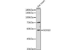 Western blot analysis of extracts of Rat heart, using SOX10 antibody (ABIN6134484, ABIN6148289 and ABIN7101829) at 1:1000 dilution. (SOX10 Antikörper)