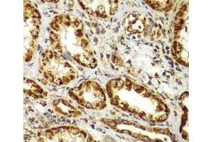 Immunohistochemistry of paraffin-embedded Human kidney using SMAD9 Polyclonal Antibody at dilution of 1:100 (40x lens).