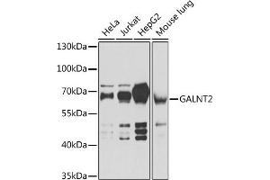 Western blot analysis of extracts of various cell lines, using G antibody (ABIN6133219, ABIN6140940, ABIN6140941 and ABIN6222644) at 1:1000 dilution.