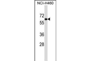 UGT2B11 Antibody (C-term) (ABIN657441 and ABIN2846471) western blot analysis in NCI- cell line lysates (35 μg/lane). (UGT2B11 Antikörper  (C-Term))