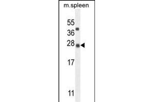 Antibody (N-term) (ABIN655108 and ABIN2844740) western blot analysis in mouse spleen tissue lysates (35 μg/lane). (KIAA1143 Antikörper  (N-Term))