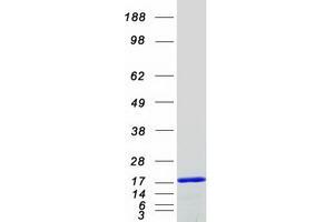 Validation with Western Blot