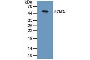 Detection of Recombinant SHC3, Human using Polyclonal Antibody to SHC-Transforming Protein 3 (SHC3) (SHC3 Antikörper  (AA 188-433))