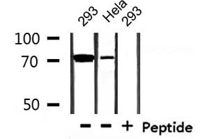 Western blot analysis of extracts from 293 and Hela , using MAP3K3 Antibody.