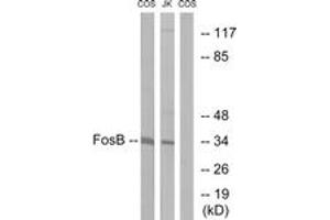 Western Blotting (WB) image for anti-FBJ Murine Osteosarcoma Viral Oncogene Homolog B (FOSB) (AA 12-61) antibody (ABIN2888837) (FOSB Antikörper  (AA 12-61))