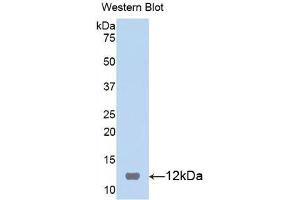 Western blot analysis of the recombinant protein. (S100B Antikörper  (AA 1-92))