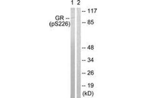 Western blot analysis of extracts from Jurkat cells treated with EGF 200ng/ml 15', using GR (Phospho-Ser226) Antibody. (GR (AA 201-250), (pSer226) Antikörper)