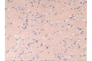 IHC-P analysis of Human Brain Tissue, with DAB staining. (POR Antikörper  (AA 77-518))