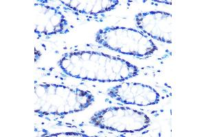 Immunohistochemistry of paraffin-embedded human colon using mSin3A Rabbit mAb (ABIN7270318) at dilution of 1:100 (40x lens). (SIN3A Antikörper)