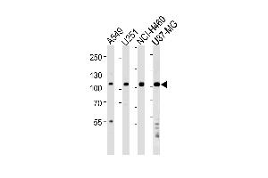 Western blot analysis of lysates from A549,,NCI-,U87-MG cell line (from left to right),using ZNF41 Antibody (N-term) (ABIN1538965 and ABIN2849171).