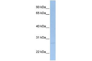 WB Suggested Anti-SIGIRR Antibody Titration:  0. (SIGIRR Antikörper  (C-Term))