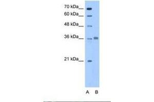Image no. 1 for anti-Aldolase C, Fructose-Bisphosphate (ALDOC) (N-Term) antibody (ABIN6738437) (ALDOC Antikörper  (N-Term))