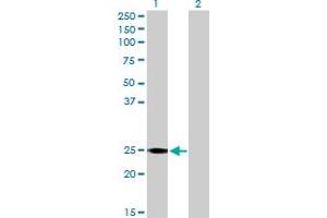 Western Blot analysis of RALB expression in transfected 293T cell line by RALB MaxPab polyclonal antibody. (RALB Antikörper  (AA 1-206))