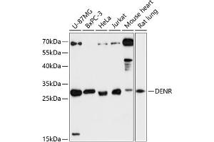 Western blot analysis of extracts of various cell lines, using DENR antibody (ABIN6133498, ABIN6139534, ABIN6139535 and ABIN6217790) at 1:3000 dilution. (Density Regulated Protein Antikörper  (AA 1-198))