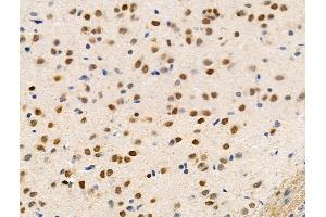 Phospho-ARRB1 (Ser412) Antibody at 1/100 staining Rat brain tissue by IHC-P. (beta Arrestin 1 Antikörper  (pSer412))