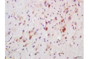 Formalin-fixed and paraffin embedded rat brain labeled with Rabbit Anti-FUT8 Polyclonal Antibody, Unconjugated  at 1:200 followed by conjugation to the secondary antibody and DAB staining (FUT8 Antikörper  (AA 311-410))