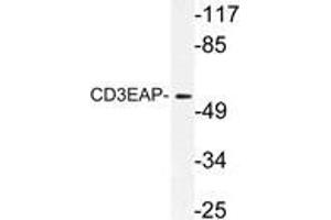 Western blot (WB) analysis of CD3EAP antibody in extracts from A549 cells. (CD3EAP Antikörper)