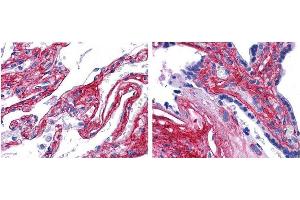 anti collagen V antibody (600-401-107 Lot 22063, 1:200, 45 min RT) showed strong staining in FFPE sections of human lung (left) with strong staining within alveoli, vessels, and in connective tissue spaces; and placenta (right) with strong staining observed in stromal and connective tissue spaces and vessel walls. (Collagen Type V Antikörper  (HRP))